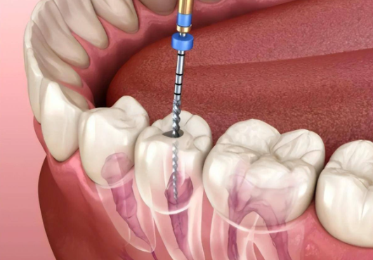 五、如何判切断管治疗价格是否合理