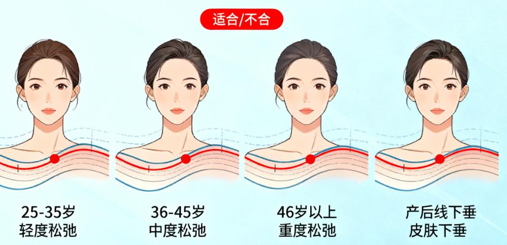 极速美雕的原理与效果到底怎么样？非手术的面部紧致和轮廓塑形技术