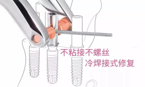 三、适用人群与禁忌人群