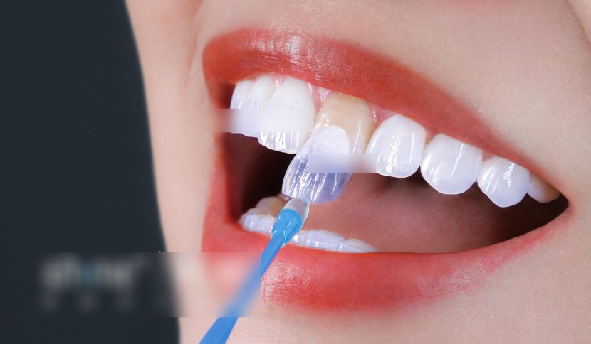 五、厦门思明思迈尔口腔