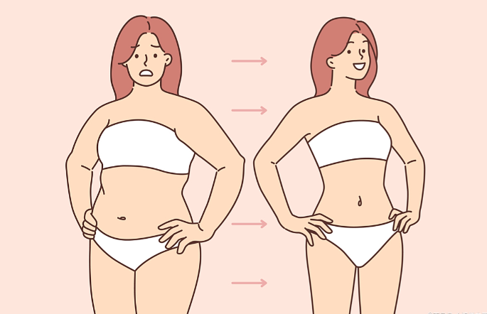 二、妈妈臀抽脂术后塑身衣穿多久？6-8周加压塑形更佳