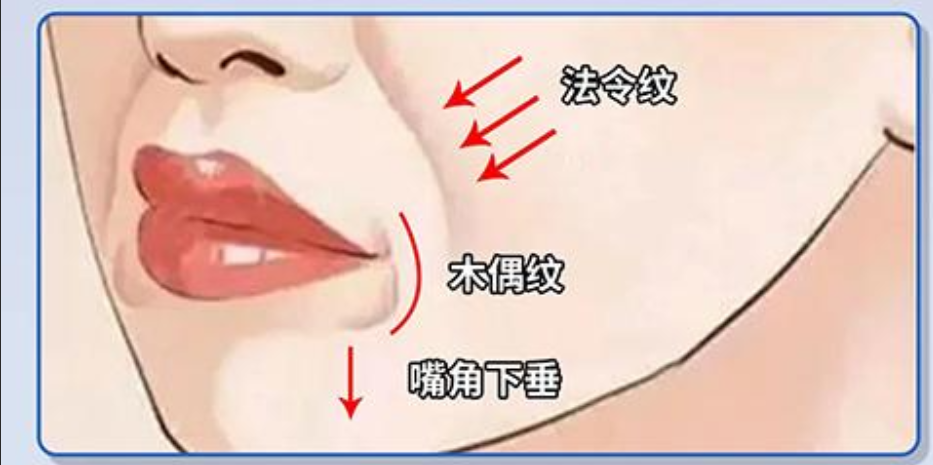 三、不同较重程度的填充方案:量体裁衣,稳准治疗