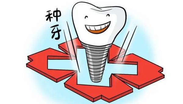 三、科斯特种植牙是哪个我国的？价格区间与选择建议