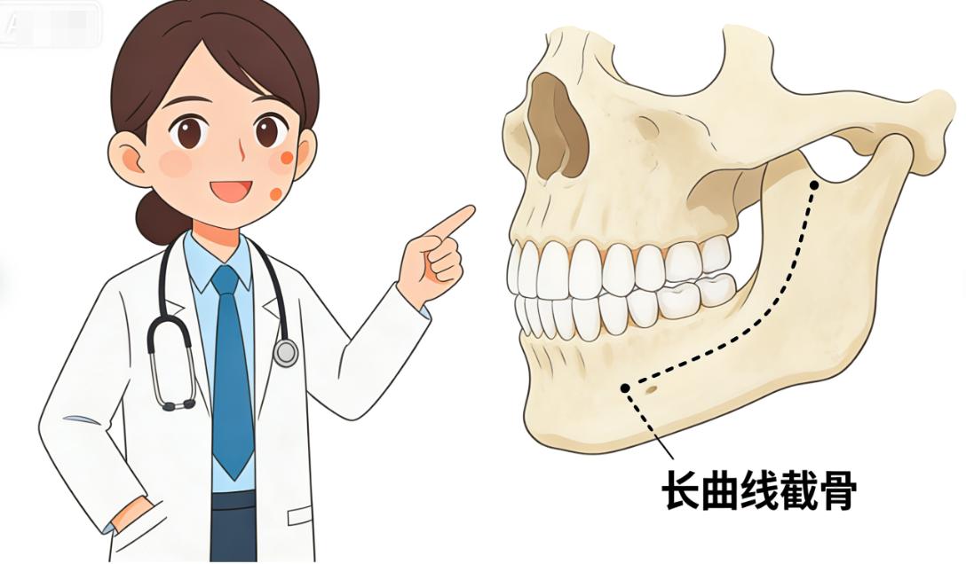 三、如何选择适合自己的术式与预算