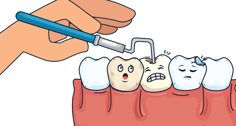 二、美可普儿童补牙的费用构成及影响因素