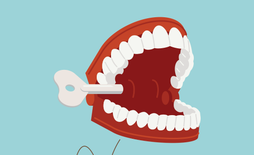 五、无挂钩义齿的局限性