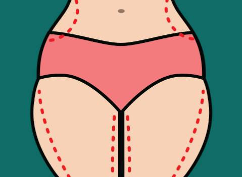 三、手术范围对手臂加副乳吸脂价格的影响