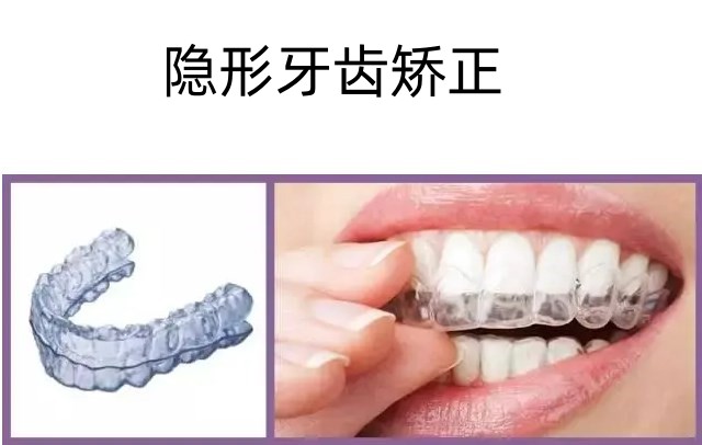 五、特殊矫正方案价格区间