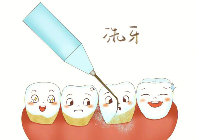 三、慈溪洗牙多少钱？私立机构价格区间68-200元