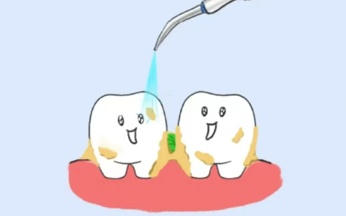 五、慈溪洗牙多少钱？洗牙卡套餐优惠，均价63元/次