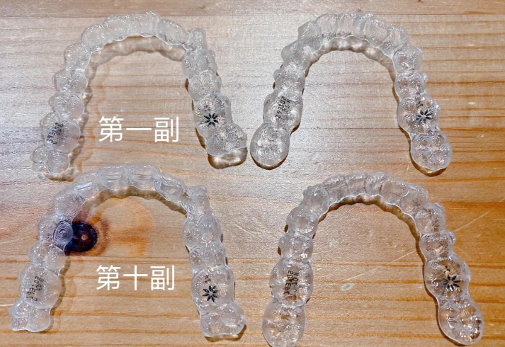 五、进口隐形矫正（如隐适美）：高端品牌，价格较高