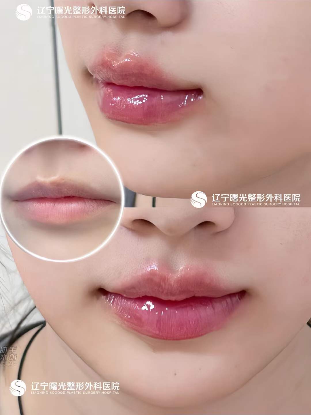 四、辽宁曙光整形外科医院