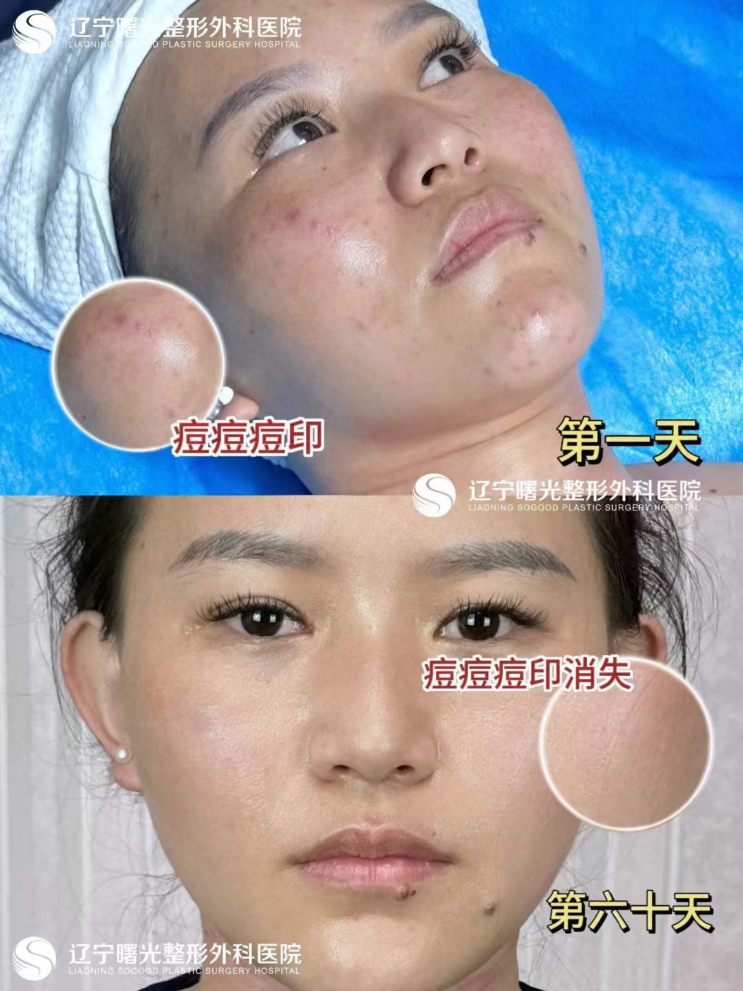 二、辽宁曙光整形外科医院