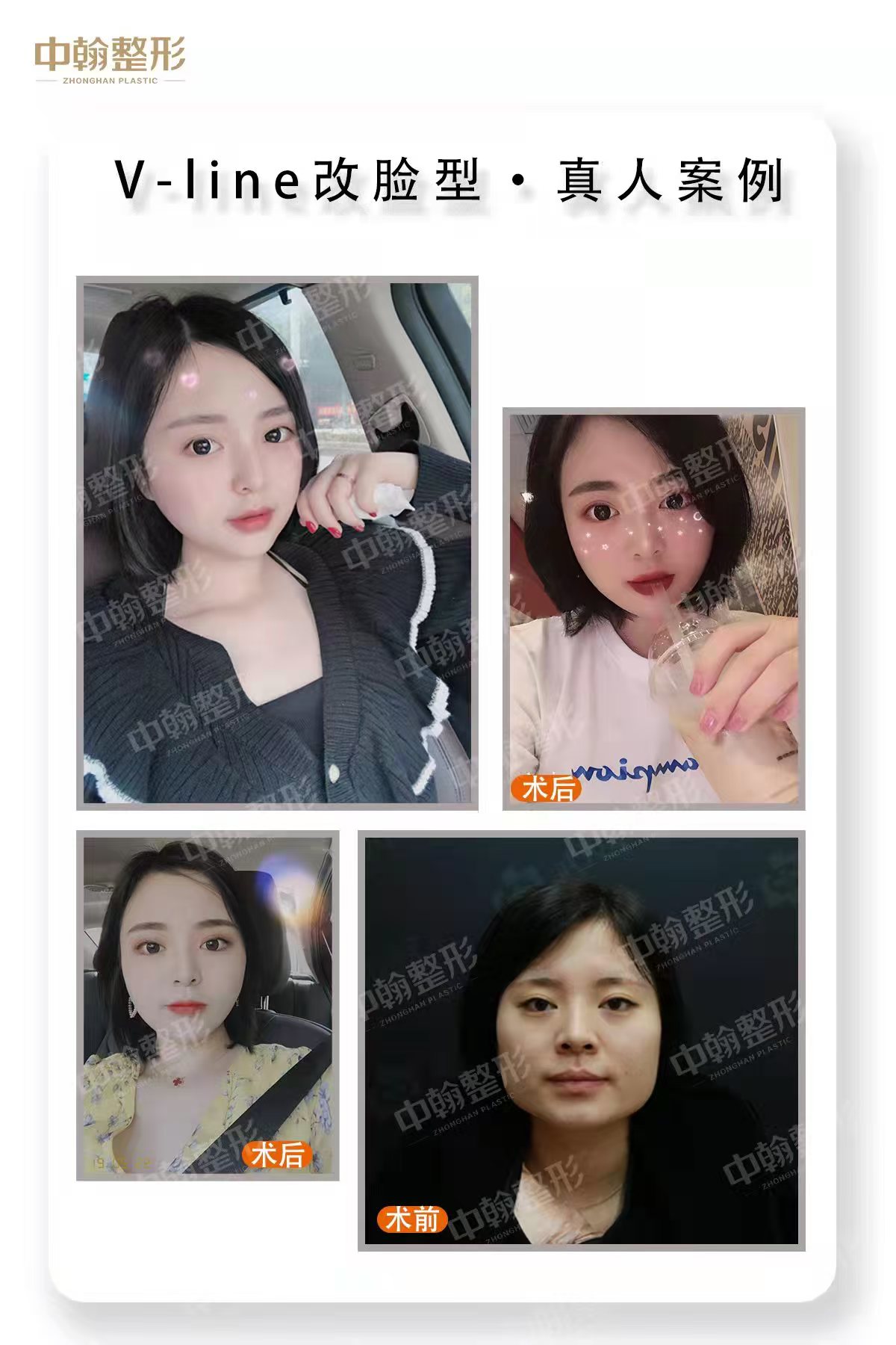 二、武汉中翰整形医院
