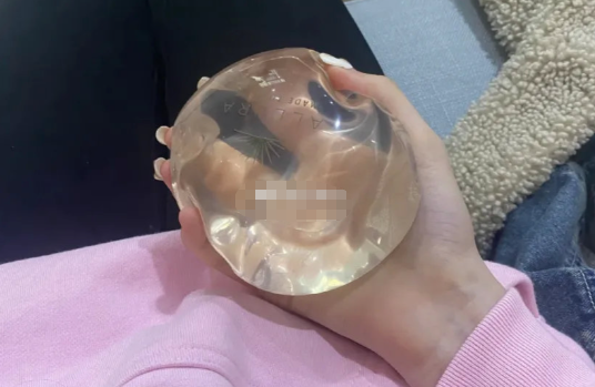 三、平胸女性如何科学选择隆胸方案