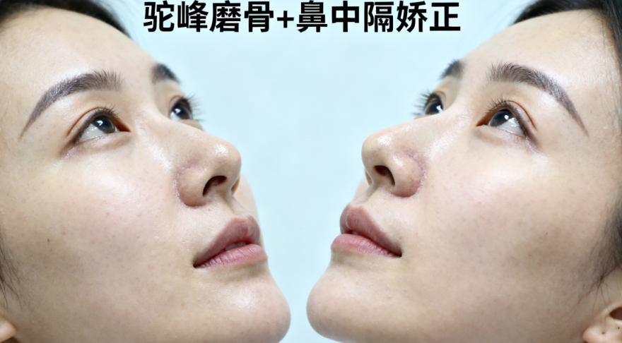 二、常州美莱美容整形鼻部整形价格区间