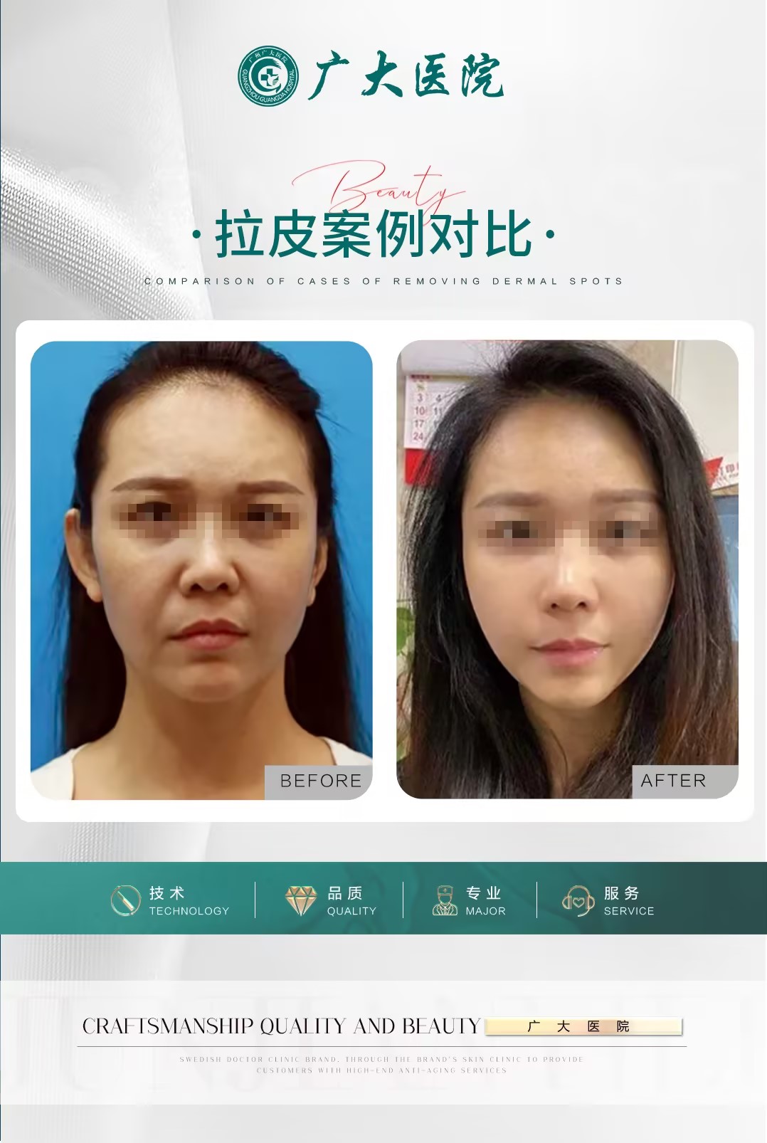 六、选择广州广大整形医院磨骨手术的建议