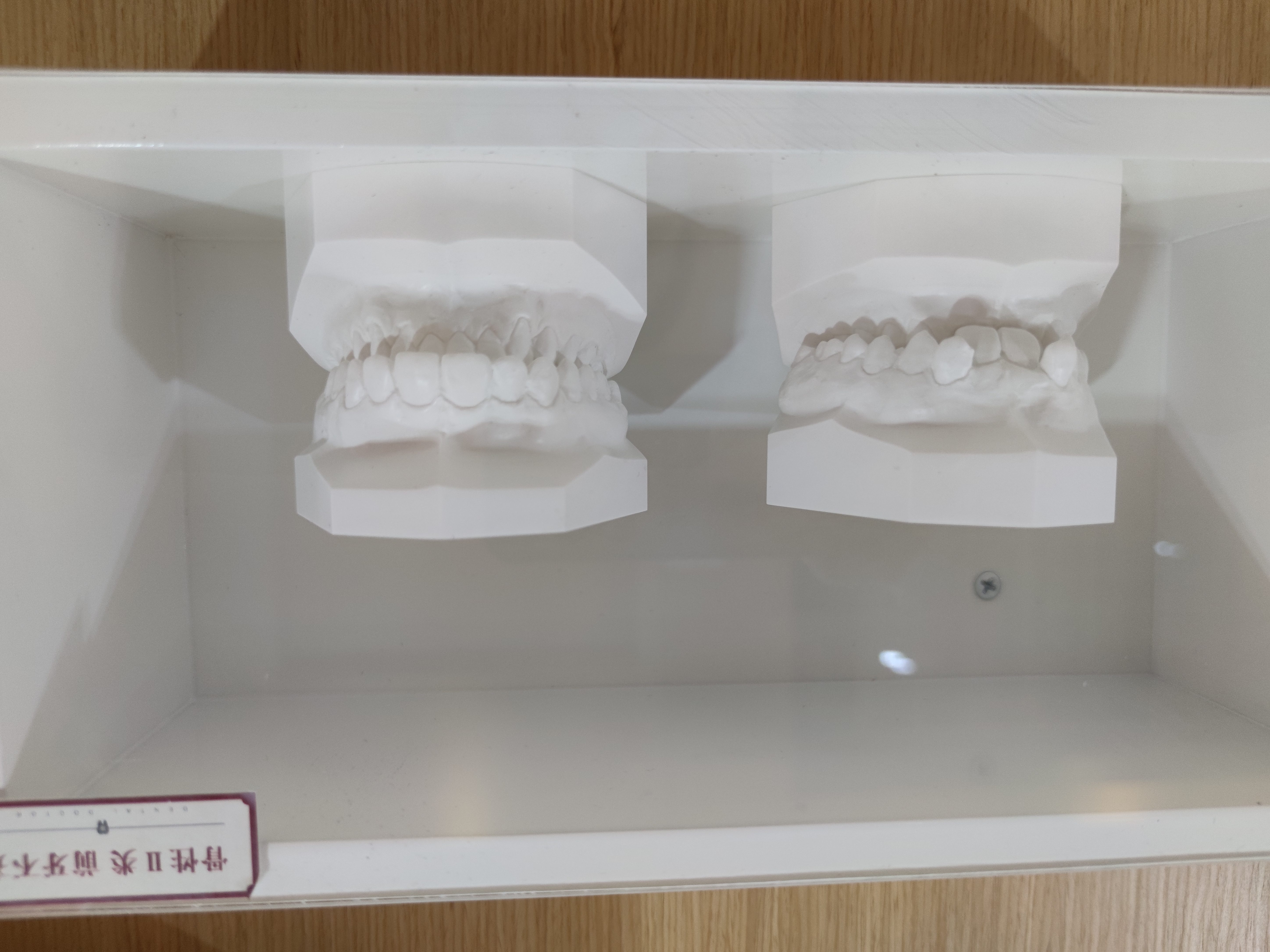 宁波成人矫正牙齿正畸医院哪家强？牙博士、美奥、雅贝康表现更稳