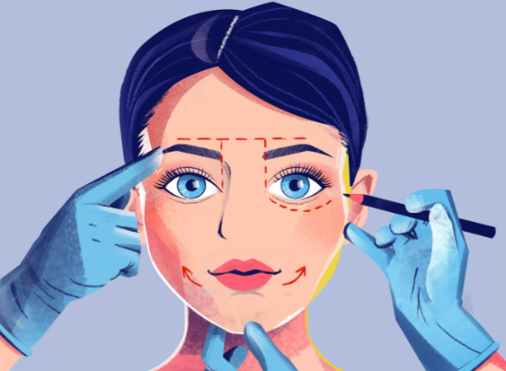 二、手术类面部提升价格