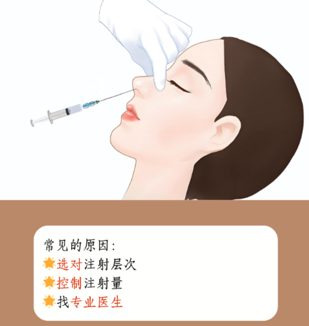 三、选择肋骨隆鼻时的注意事项