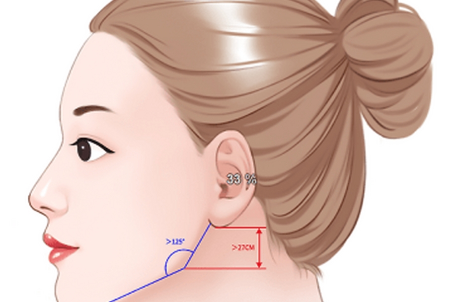 五、何锦泉磨骨手术的口碑与患者评价