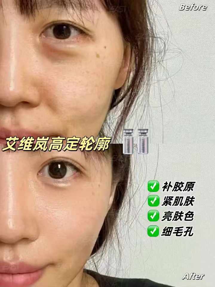 郑州东方整形是正规医院吗？医院技术过硬，口碑好，复购率高
