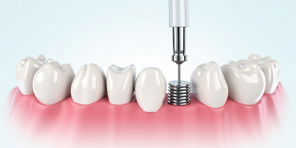 三、康奥益齿口腔