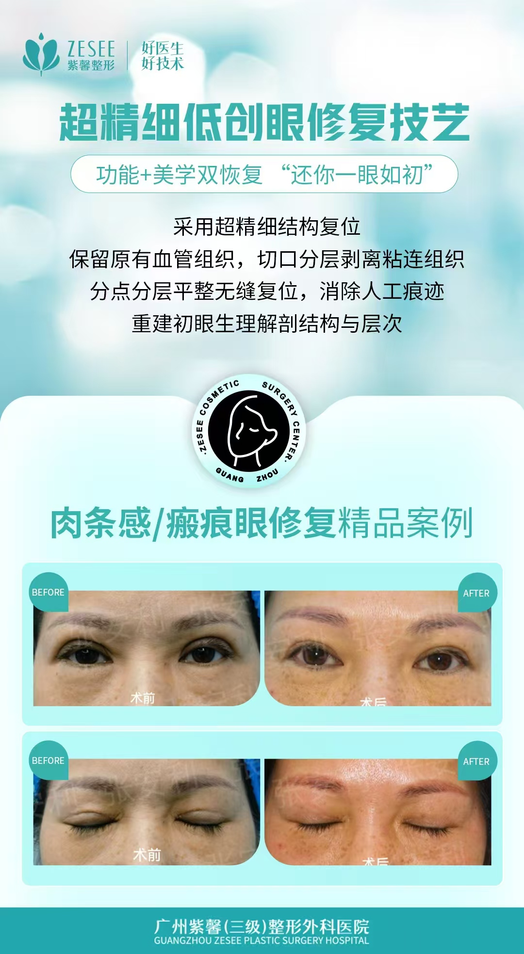 二、广州紫馨的M22超光子：技术优势与适用人群