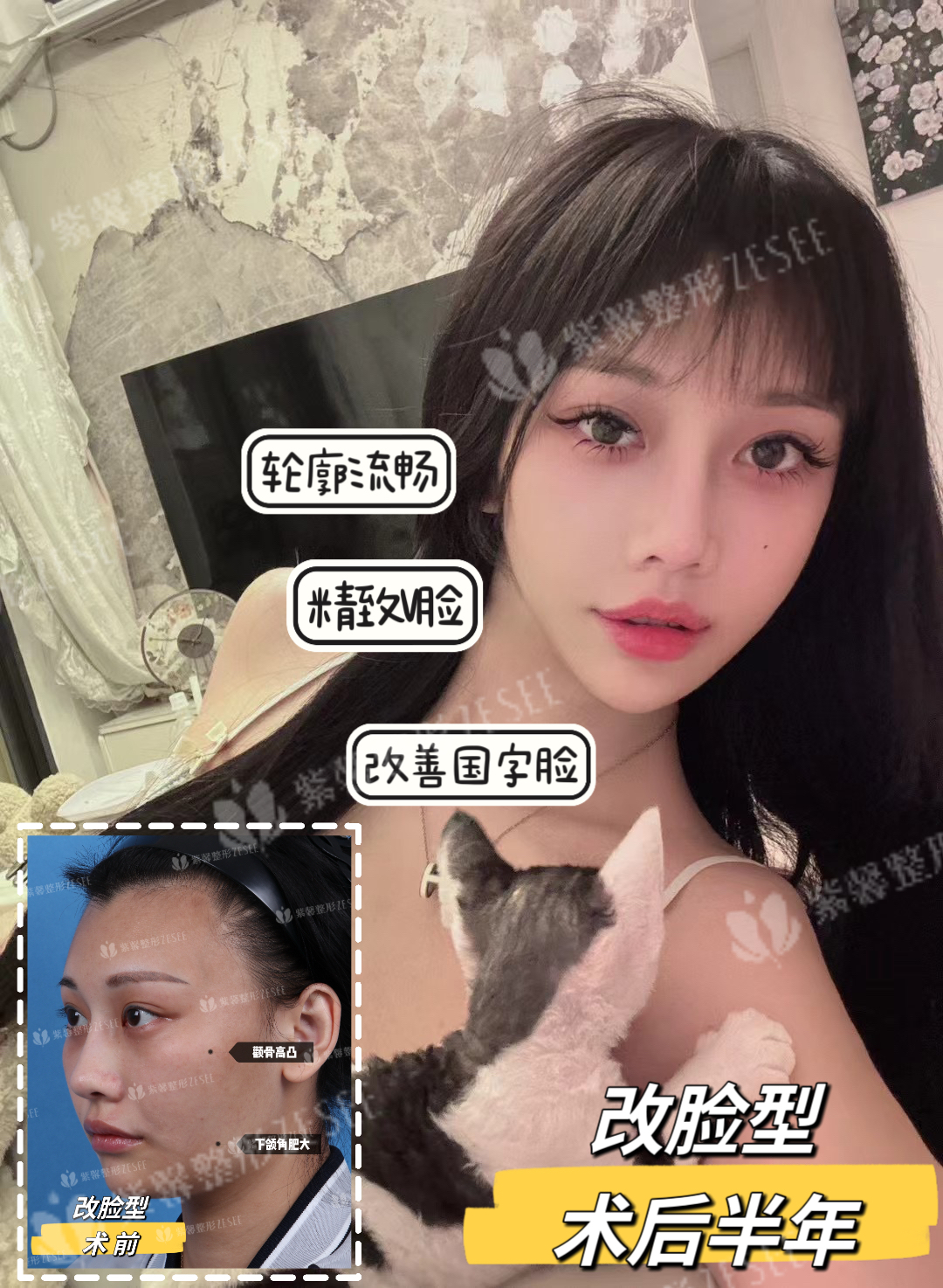 三、广州紫馨的M22超光子：术后护理与注意事项