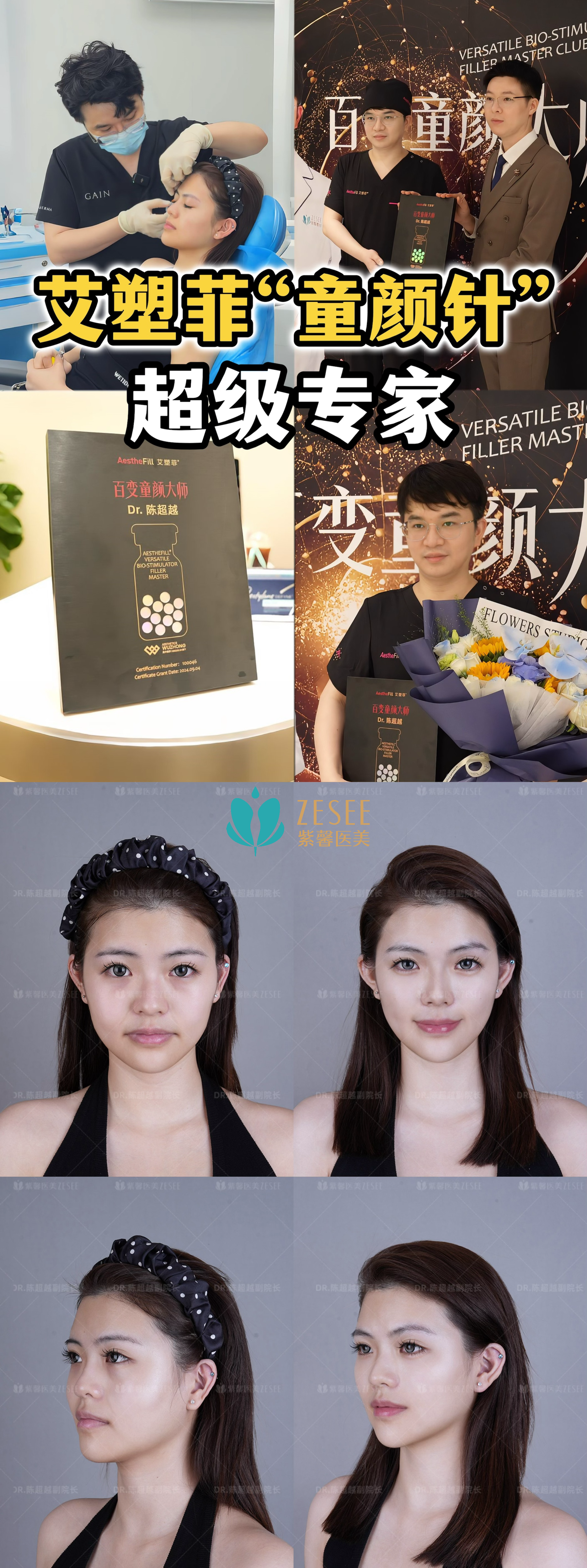 二、广州紫馨美容医院隆胸技术是否安心有效？真实实例分享