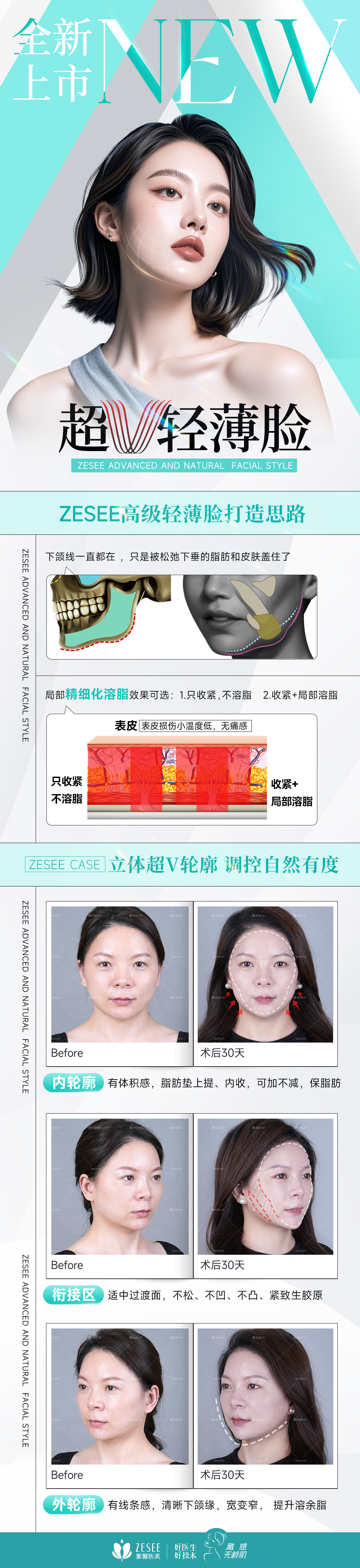 三、广州紫馨美容医院隆胸医生团队介绍与资质说明