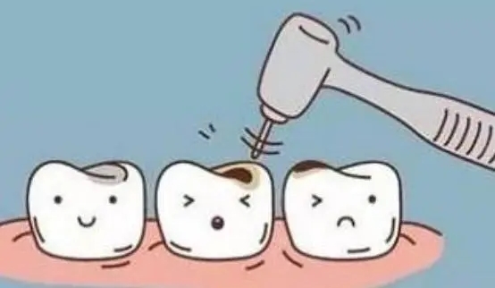 二、玻璃补牙的适用人群与优势