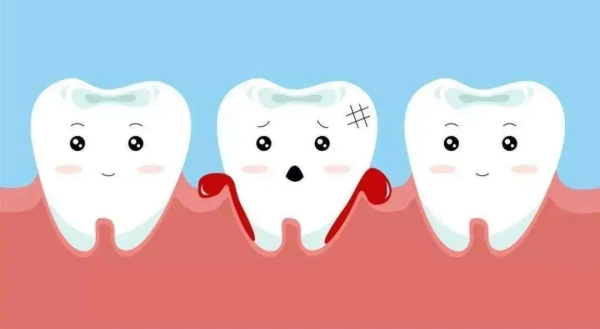 四、玻璃补牙与其他材料的对比