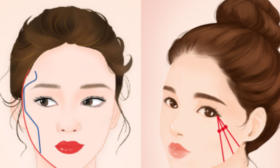 张笑天颧骨内推多少钱？北京起价3.5万，联合手术高达12万以上