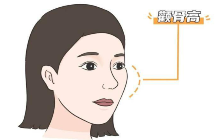 张笑天颧骨内推多少钱？影响价格的其他因素