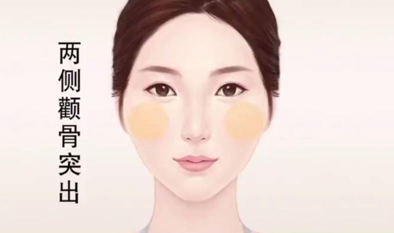 张笑天颧骨内推多少钱？总结与建议