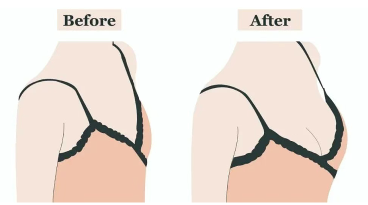 二、邵阳市中心医院隆胸整形科