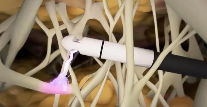 九、镇江吸脂哪个医院好?选择建议