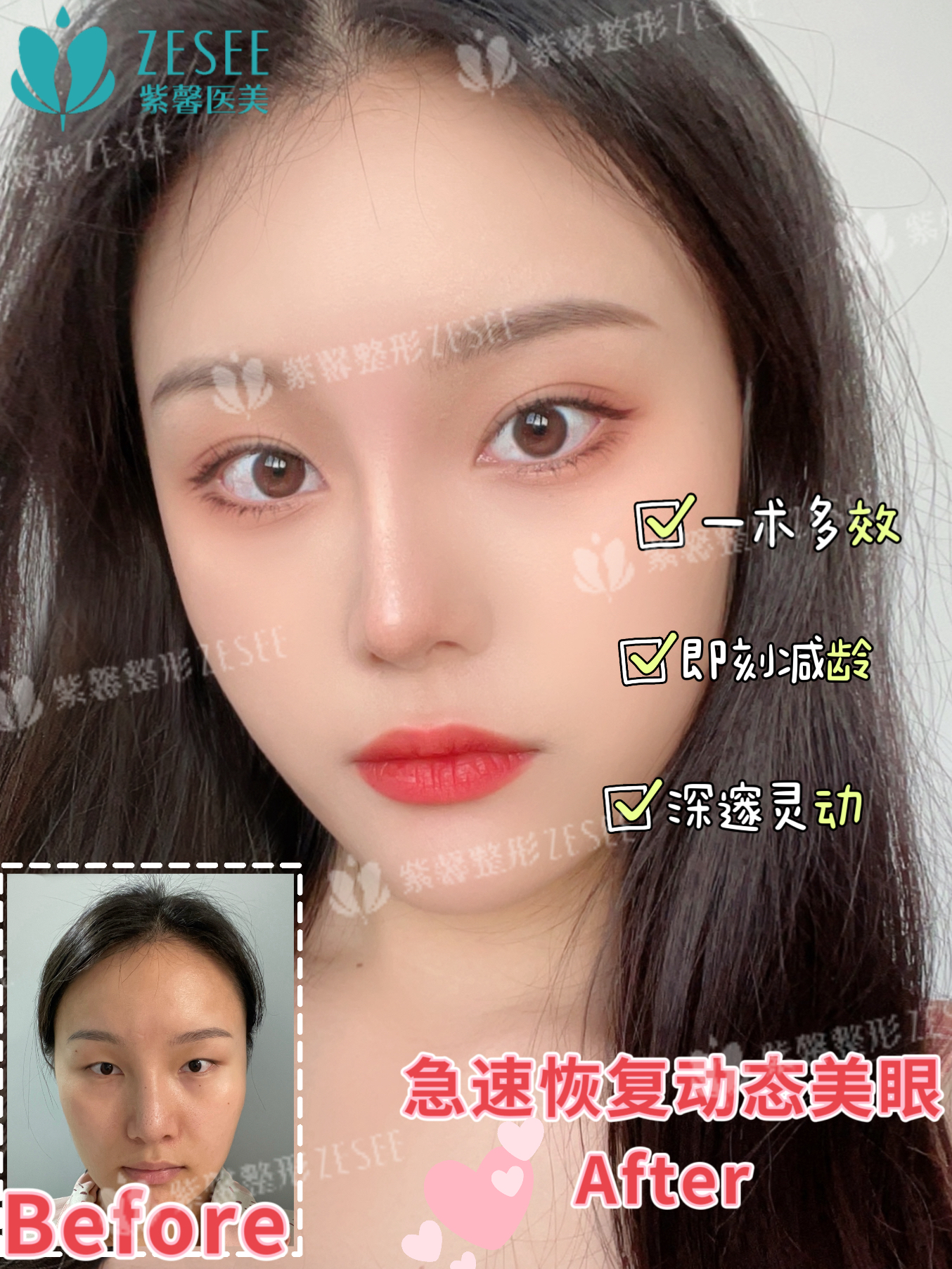 四、广州紫馨医疗美容医院