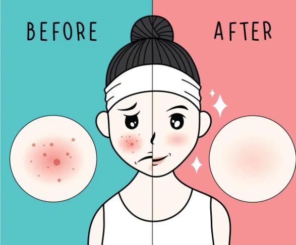 三、广州美莱医疗美容光子嫩肤价格是否透明