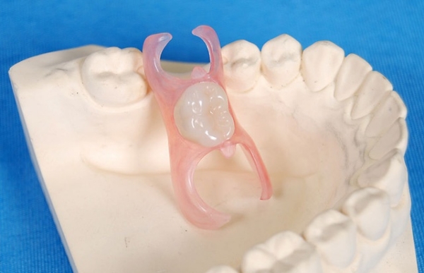 活动义齿哪种材料质量好又舒服？选树脂、钴铬合金、纯钛告别口腔不适