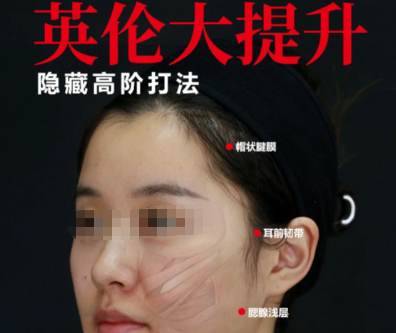 五、艺星医疗美容医院打英伦大提升是否适合你?选择建议