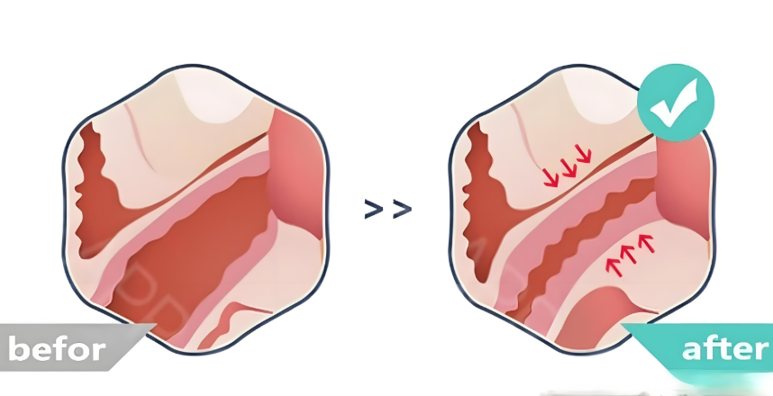 三、菲蜜丽紧缩的适用人群与注意事项｜科学选择治疗方案