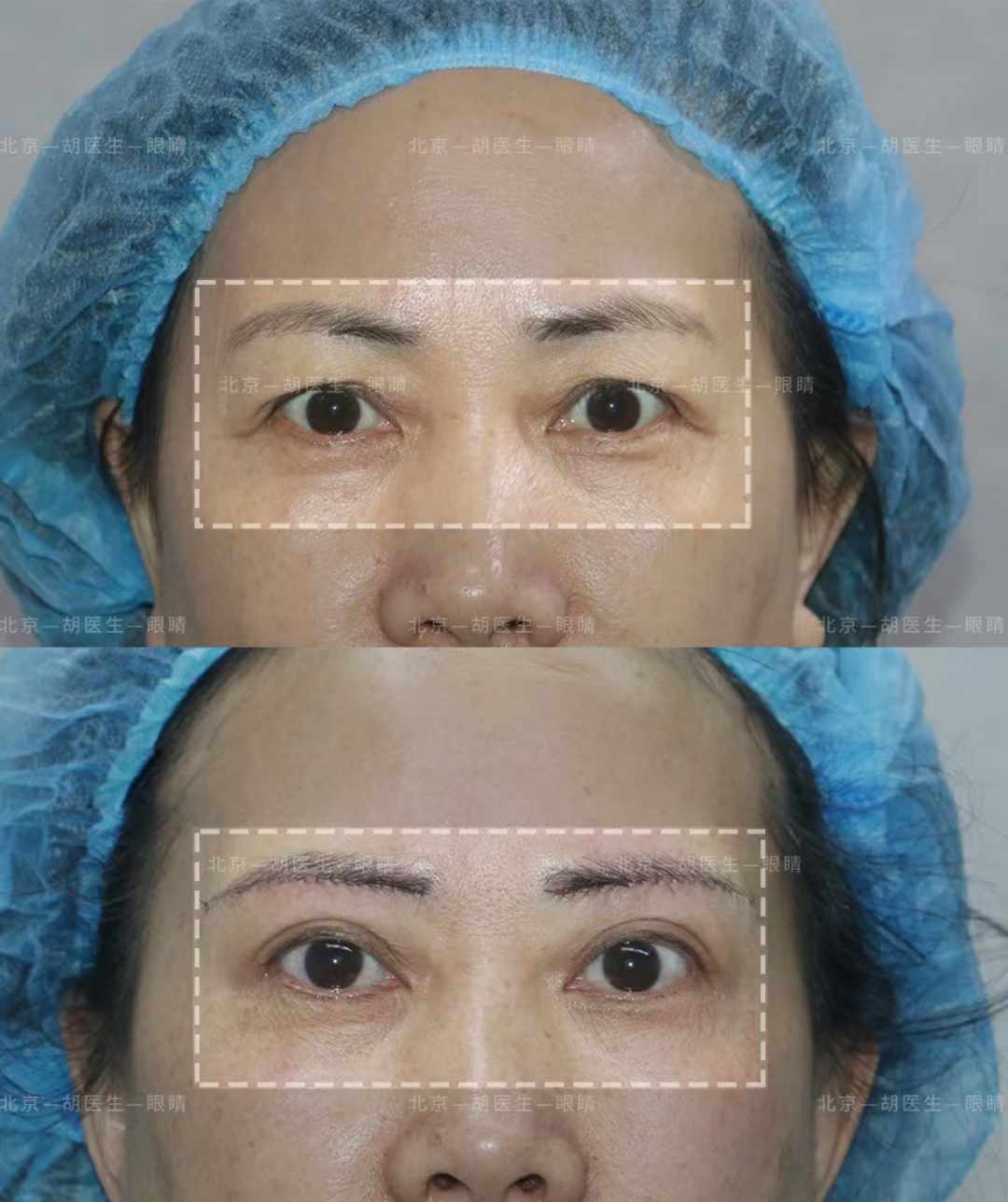 三、北京丽都曹令医生项目对比：米兰柏羽资质优势