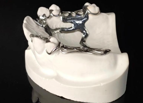 二、牙齿缺失后未及时修复