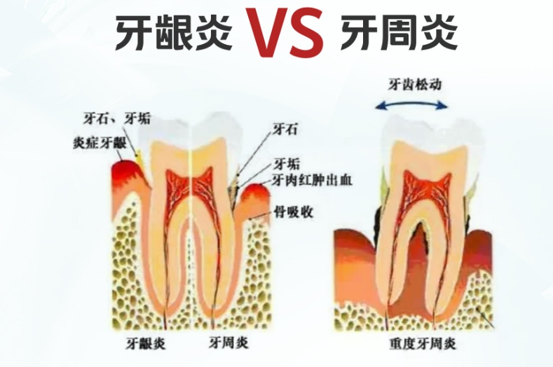 四、长期维护：防止复发的必修课