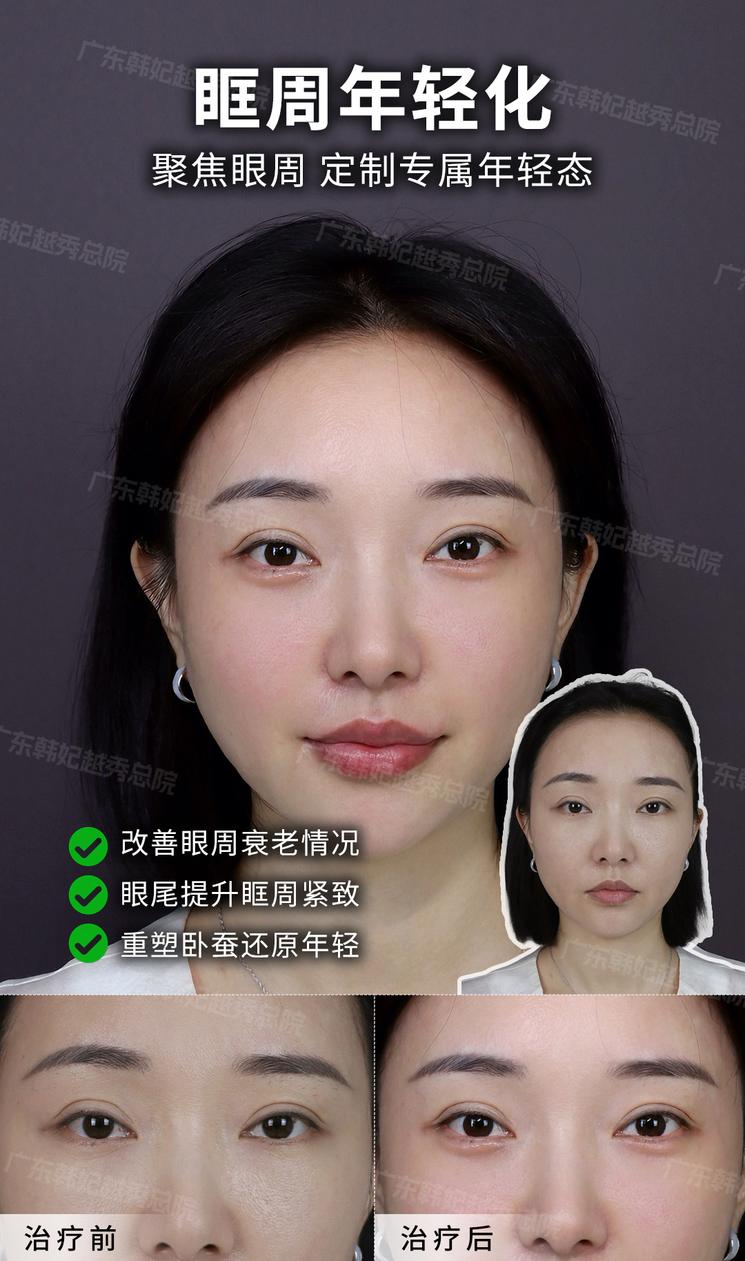 四、广州韩妃整形医院隆胸项目用户反馈