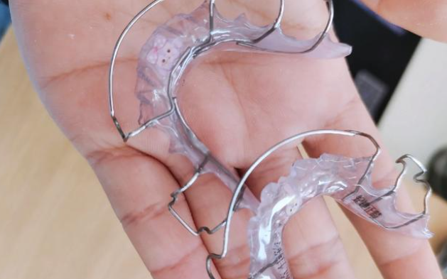 二、降低牙缝矫正复发率的三大关键措施