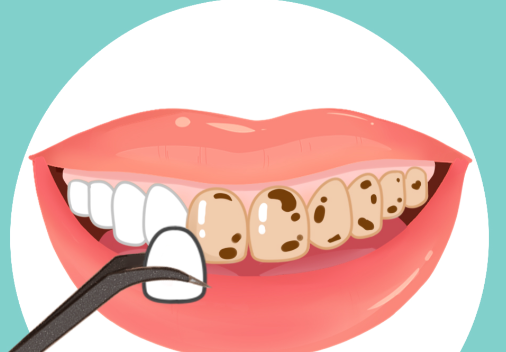 四、选择矫正前需规避的认知误区