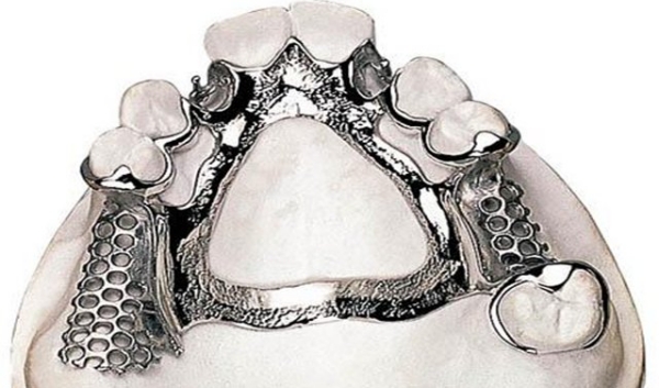 二、镶牙上牙13颗下牙14颗正常吗｜是否需要镶牙？